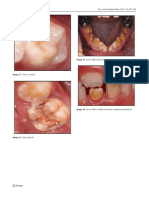 238 Eur Arch Paediatr Dent (2017) 18:225-242