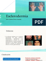 Es Clerodermia