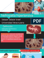 Nefropatiahipertensiva 171006025712