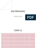 Ekg Osce Latihan