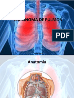 Ca pulmon