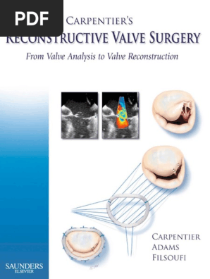 語学・辞書・学習参考書 Reconstructive valve surgery 1771004790?v=1