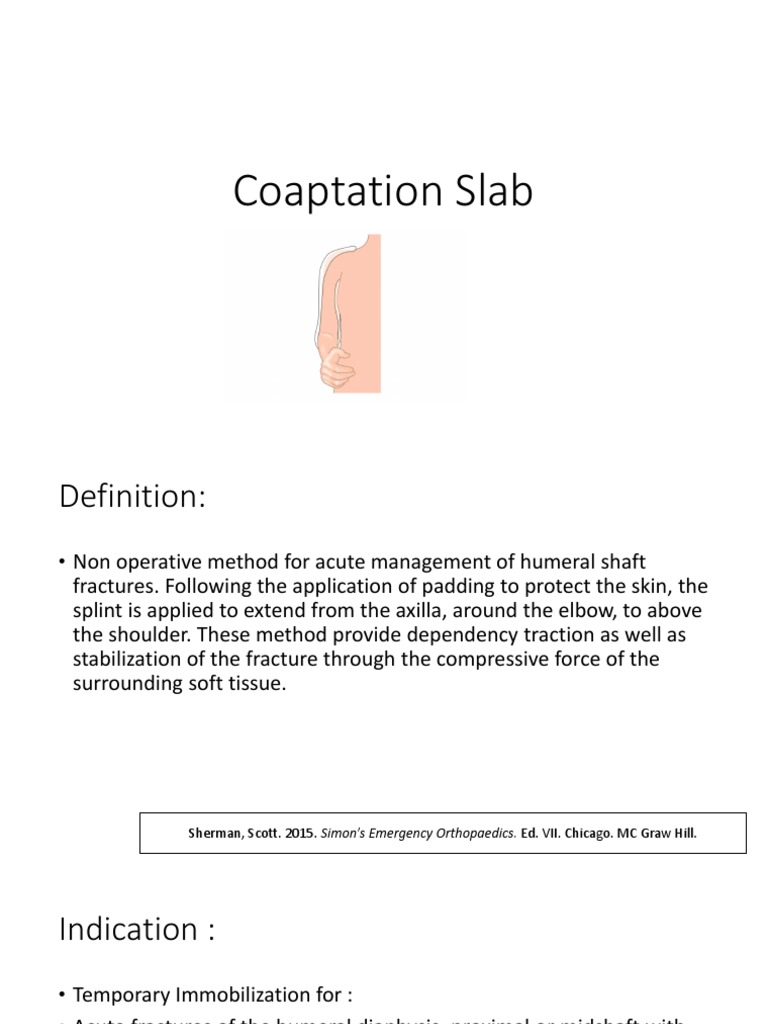 Coaptation Splint vs U-Slab for Humerus | PDF | Arm | Elbow