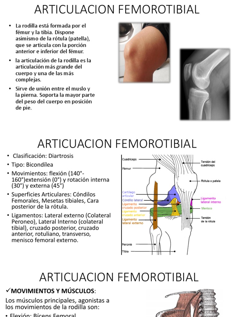 Articulacion Femorotibial