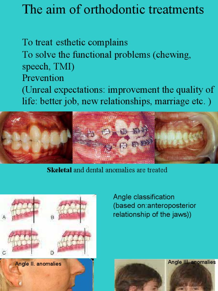 Orthodontic Treatment Overview | PDF | Orthodontics | Face