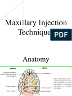 Maxillary Injection Techniques