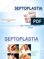 Septoplastia Iq9 160927214026
