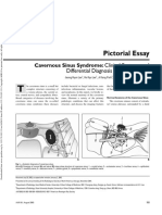 Pictorial Essay: Cavernous Sinus Syndrome