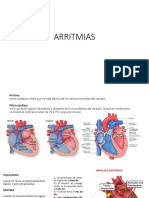 ARRITMIAS