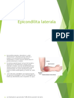 Epicondilita laterala