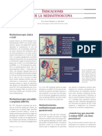 Indicaciones de La Mediastinos PDF