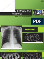 Patrones de Enfermedad Pulmonar DX IMAGENES