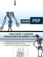 Lesionesdelamano 170227160618 PDF