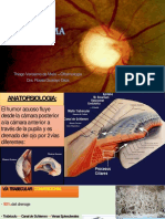 Glaucoma 