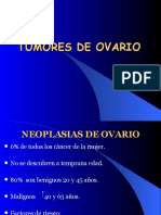 tumores-de-ovario-12562 (1)