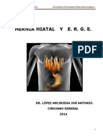 Hernia Hiatal y ERGE