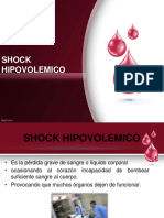 Shock Hipovolemico