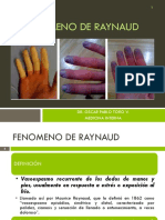 Fenómeno de Raynaud: Dr. Oscar Pablo Toro V. Medicina Interna