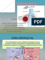 asmabronquial-170207213133