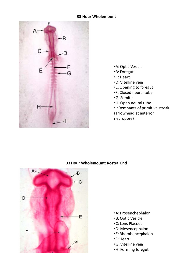48 Hour Chick Embryo Serial Sections