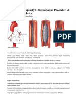 Angioplasty