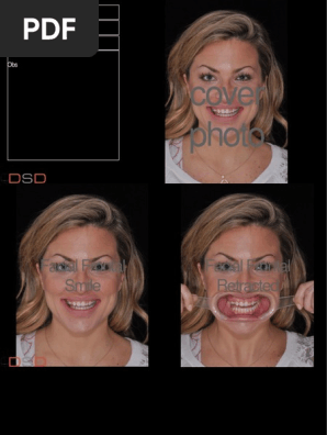 DSD Template
