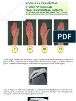 Funcionalidad de Extremidad Superior Clasificacion de House para Pulgar Incluido PDF