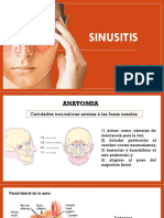 Sinusitis: Causas, síntomas y tratamiento