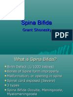 Spinabifida 131110205348 Phpapp01