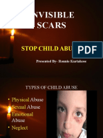Invisible Scars: Stop Child Abuse