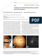 Traumatic optic neuropathy and central retinal artery occlusion following blunt trauma to the eyebrow.pdf