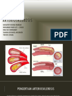 Arteriosklerosis