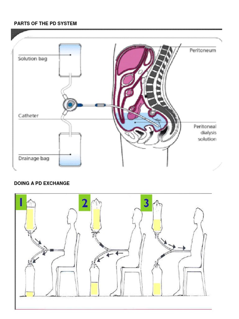 Parts of The PD System | PDF