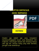 Eruptio Difficilis - Gigi Impaksi