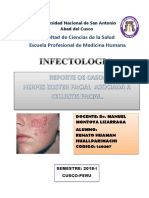 Herpes Zoster Facial