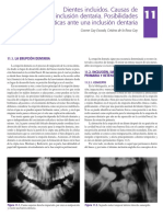 Inclusiones Dentarias Gay Escoda PDF