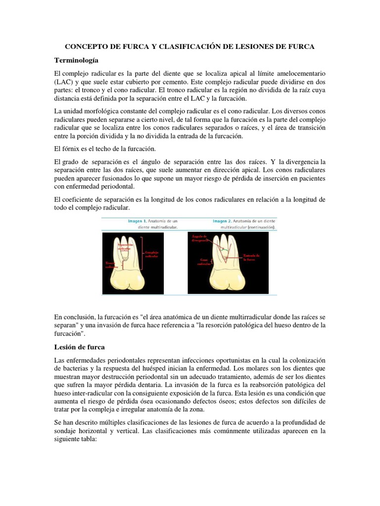 Clasificación y diagnóstico de furcas dentales | PDF | Radiografía | Hueso
