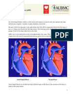 Atrial Septal Defect