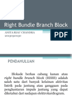 Right Bundle Branch Block