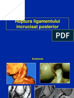 05 - Ligament incrucisat posterior.ppt