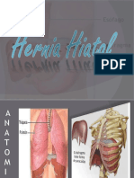 seminariohernia-100507111700-phpapp02