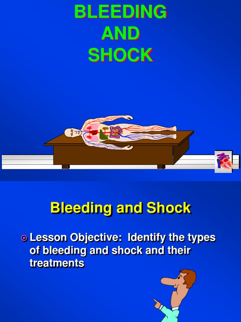 Bleeding shock Shock (Circulatory) Bleeding