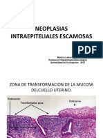 Neoplasias 2017 Intraepiteliales Escamosas