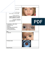 Often Autosomal Dominant - Defect of Lid, Iris, Lens, Retina, or Choroid - Always Inferior