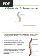 Download Cifosis de Scheuermann by Mayan King SN38275690 doc pdf