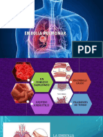 Embolia pulmonar