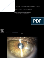Corneal Ulceration and Episcleritis Associated With Wiskott - Aldrich Syndrome