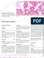 soft tissue tumours