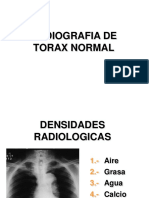 1. Rx. normal de torax.pdf