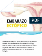 embarazo ectopico (1)